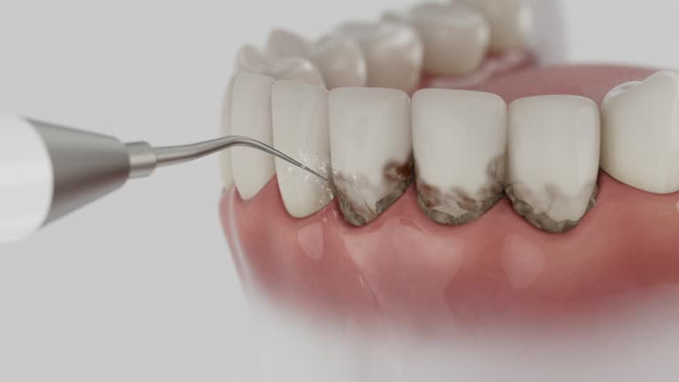 Reliable Dental contractor in Gibsonburg, OH by Dentist Open Now